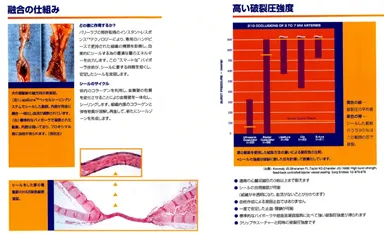 縫合糸反応性肉芽腫への対応について