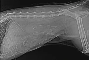 尿管ステント設置