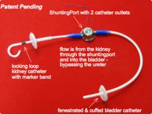 SUBシステム設置