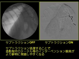 天井にはフレキシブル大型スレーブモニターが設置