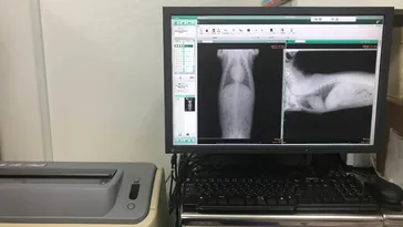 レントゲン検査室