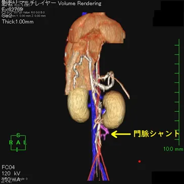 CT検査室