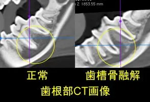 歯根部CT画像